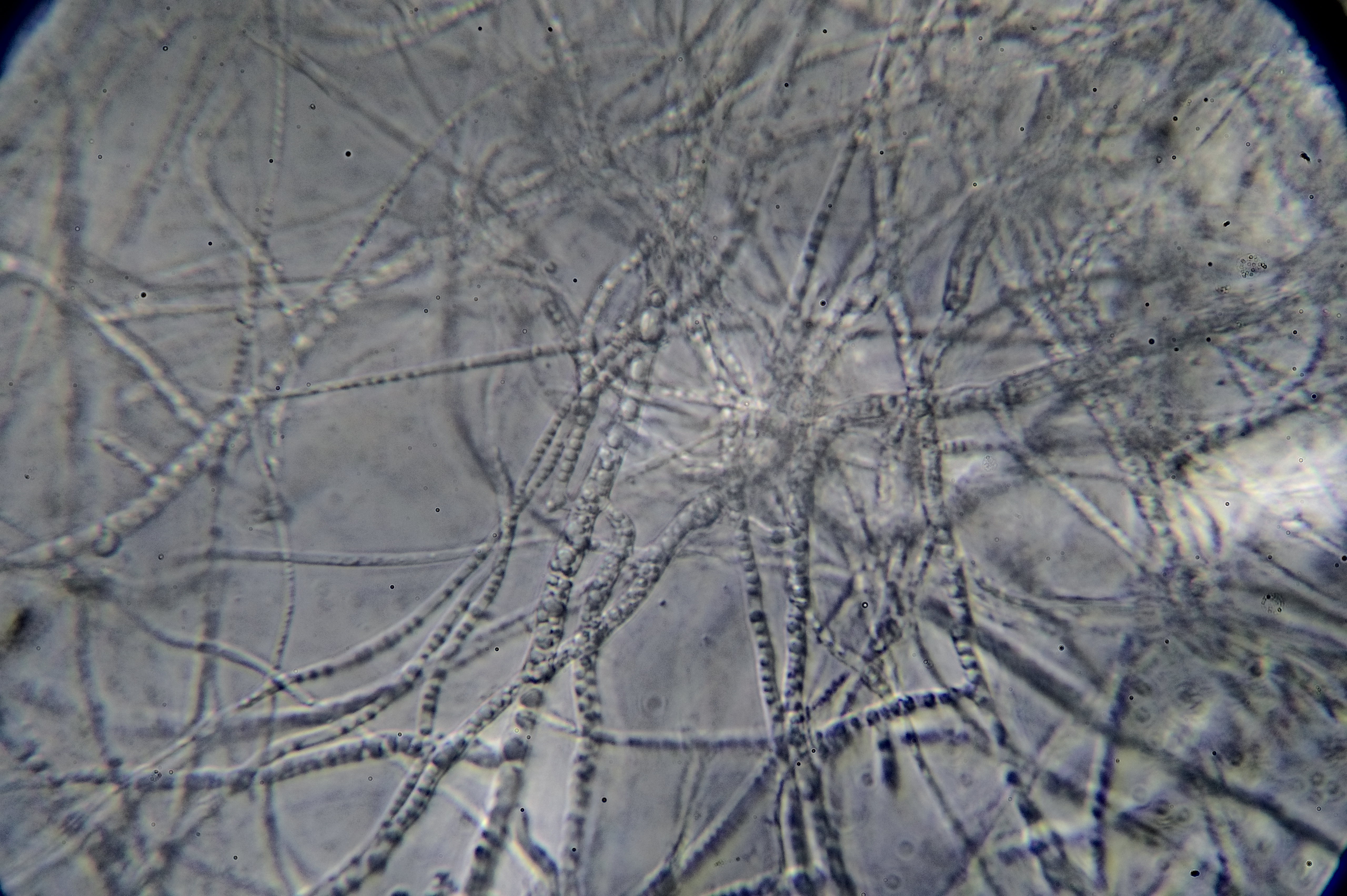 The microstructure of Xanthoria