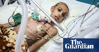 ‘Not a normal war’: doctors say children have been targeted by Israeli snipers in Gaza