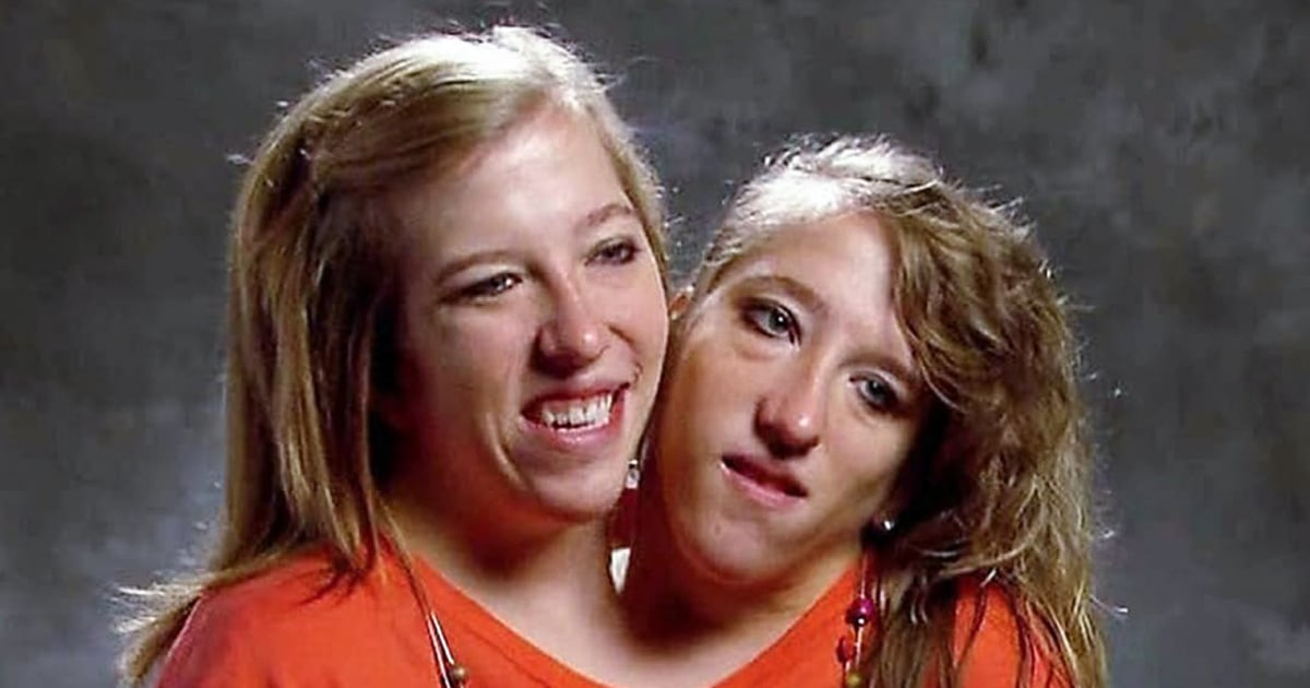 Conjoined twin Abby Hensel is now married